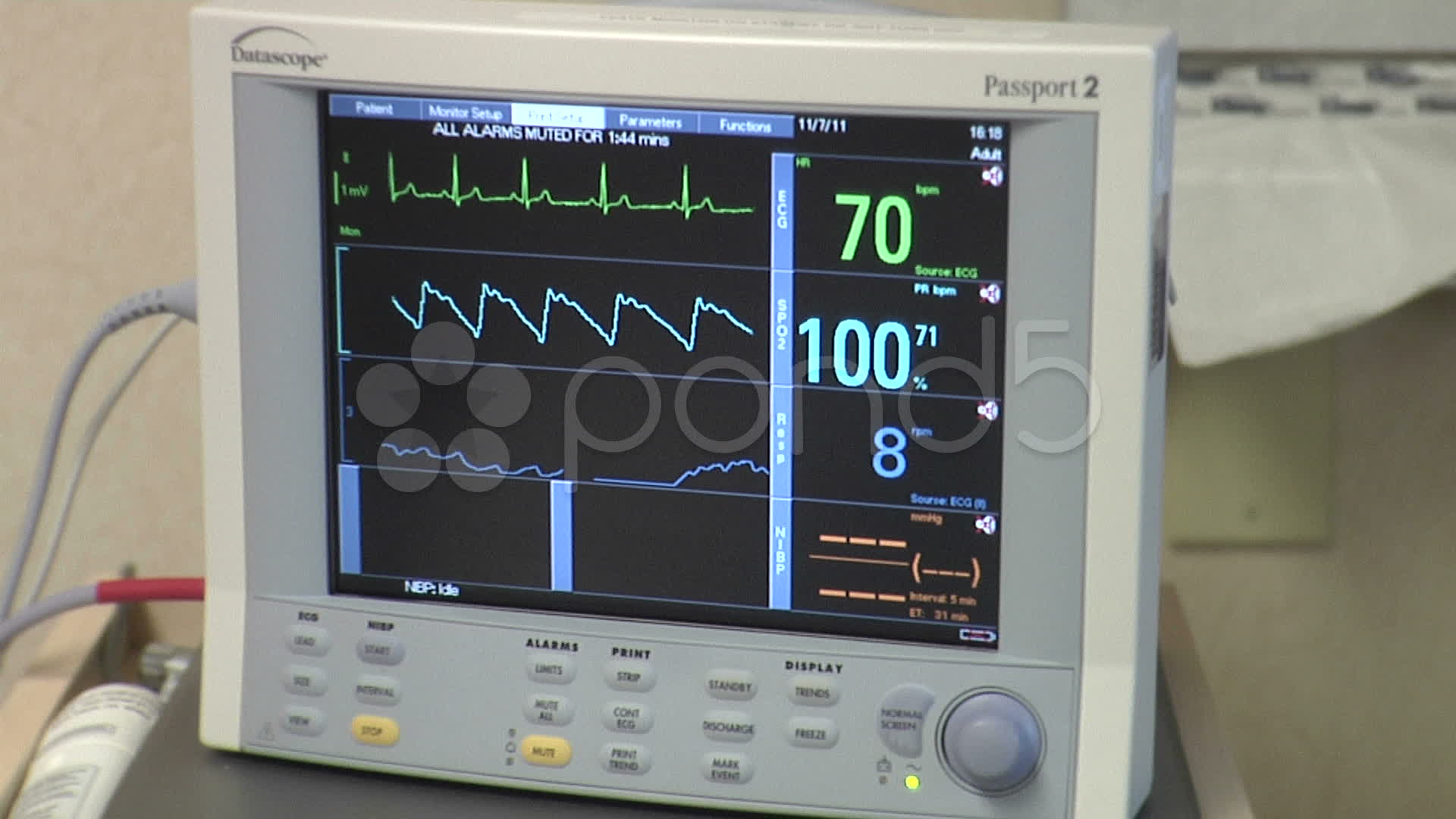 Appliance, Medical Heart Monitor